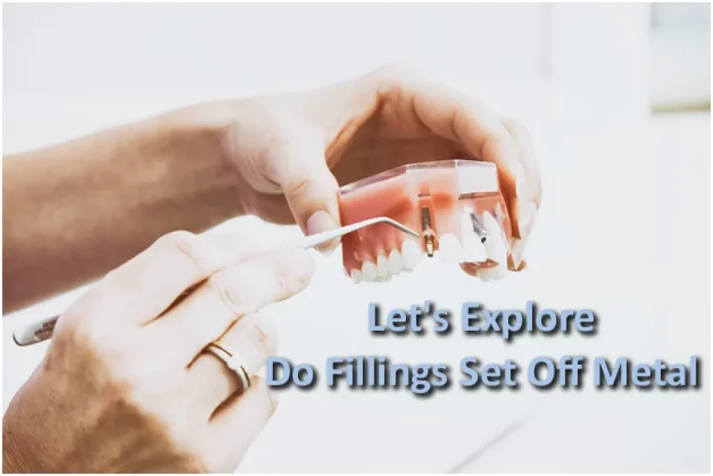 do fillings set off metal detectors